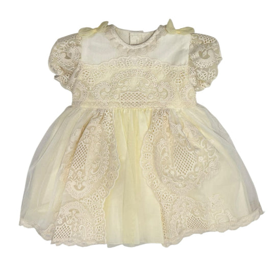 Edwarda Tower Yellow Lace Girl Dress