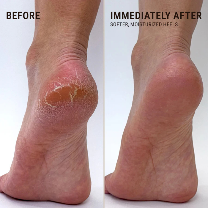 Voesh | Solemate Heel Repair Balm Lavender